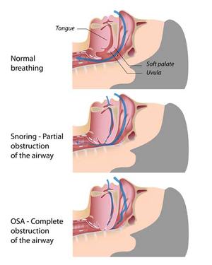 anatomy